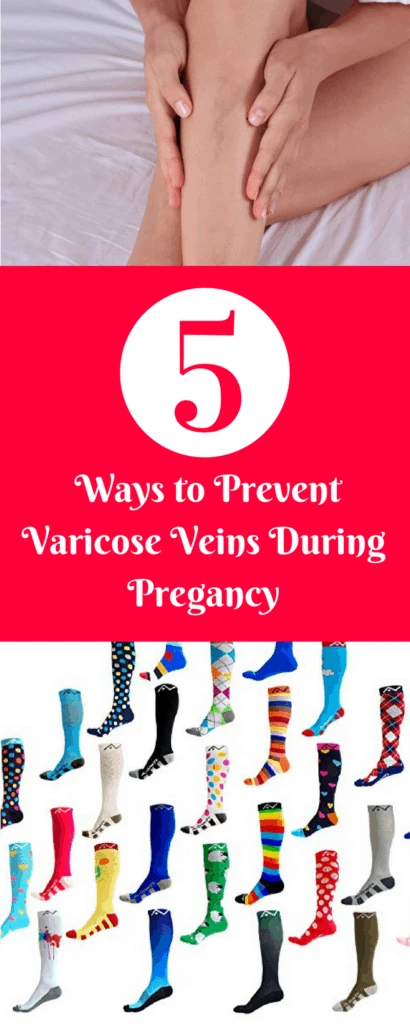 5 Ways to Prvent Varicose Veins during Pregnancy