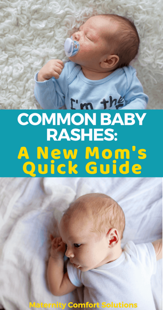 Common Baby Rashes: A New Mom's Quick Guide