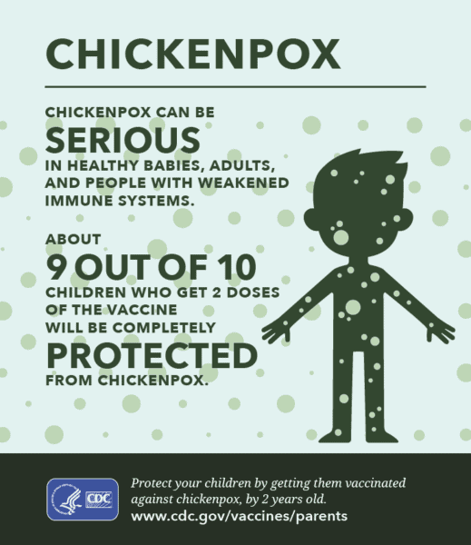 chickenpox CDC