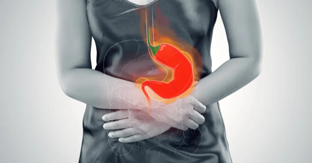 How To Relieve Heartburn During Pregnancy