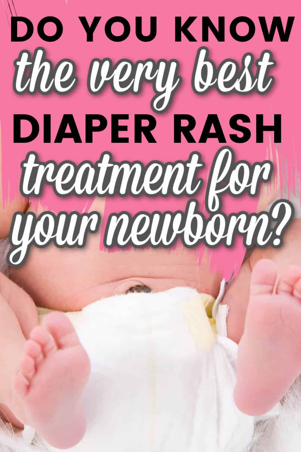 Best Diaper Rash Treatment For Infants [2023]