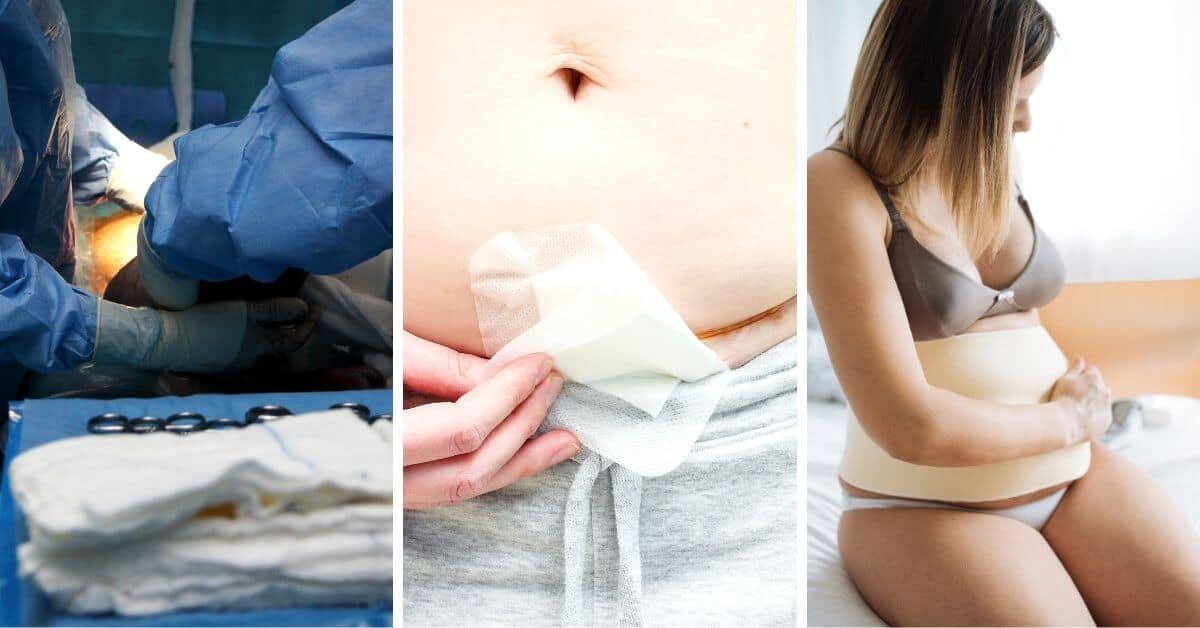 What To Pack In Your Hospital Bag For A C-Section
