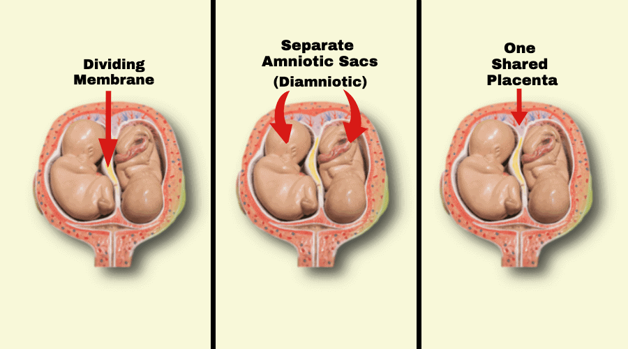 What Questions To Ask Your Doctor If You Are Having Twins